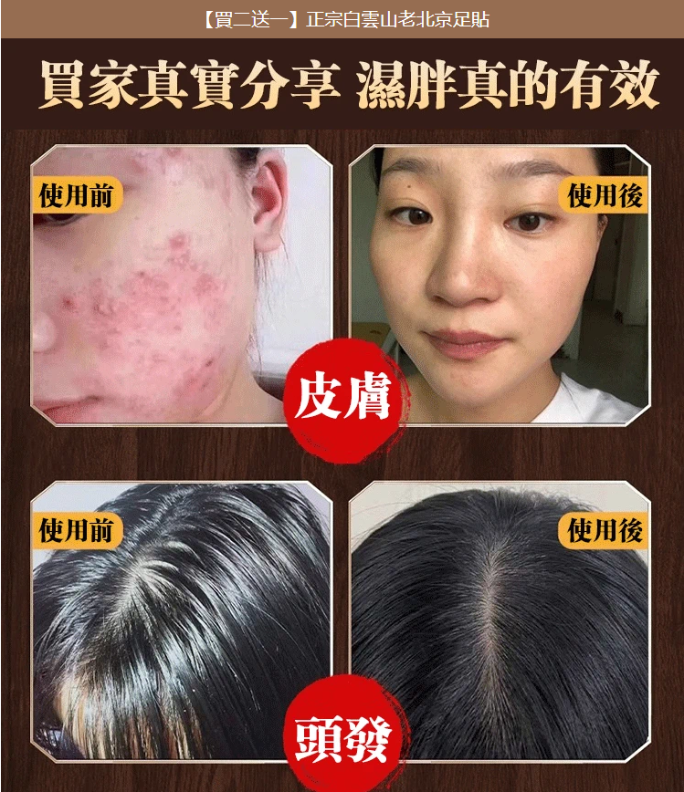 【中藥艾草穴位足貼】珍貴中藥材提取,每晚一貼,助眠除濕氣排油 減輕腰酸背痛,三天見效! 去濕排毒,消腫止痛,改善睡眠 【中藥艾草穴位足貼】珍貴中藥材提取,每晚一貼,助眠除濕氣排油 減輕腰酸背痛,三天見效! 去濕排毒,消腫止痛,改善睡眠